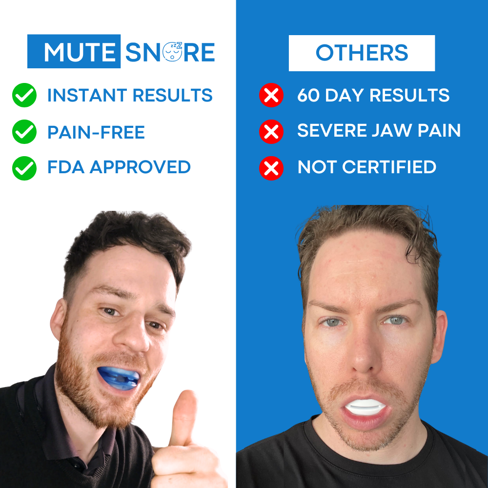 Anti Snoring Mouthpiece