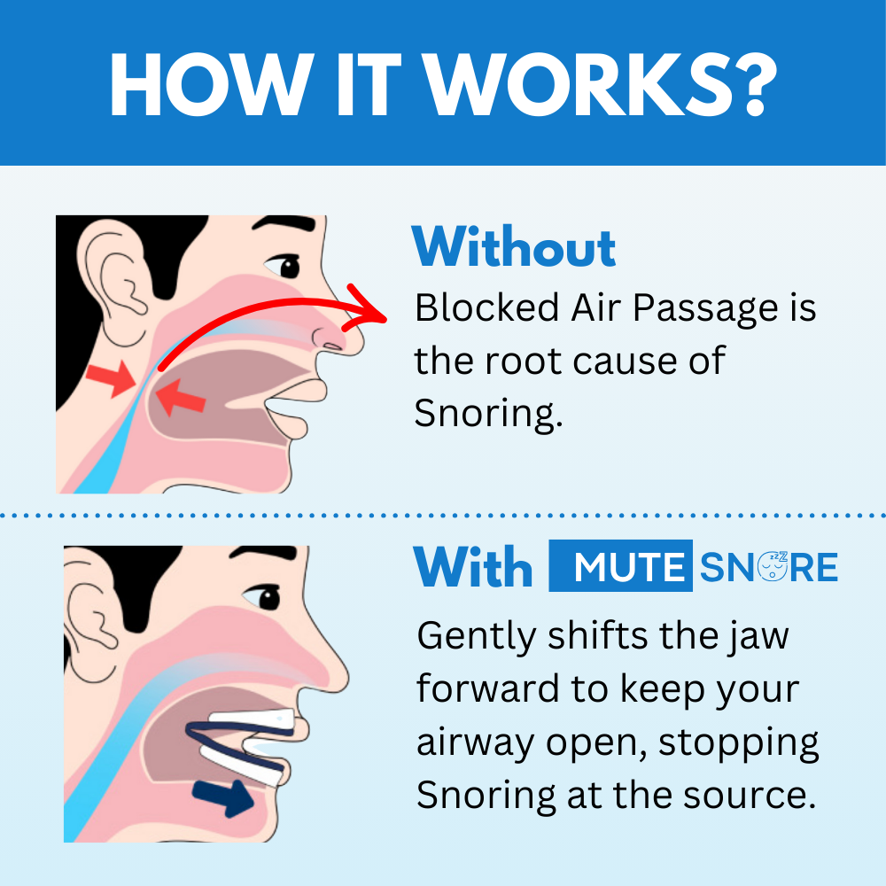 Anti-Snoring Mouthpiece